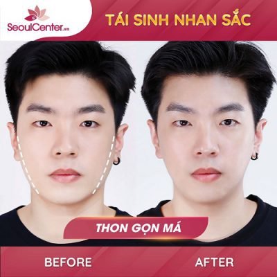 Tái sinh nhan sắc