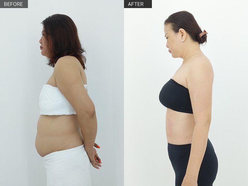 30 phút giảm mỡ bụng