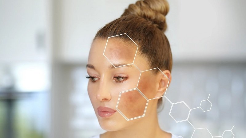 Melanin là yếu tố quy định màu sắc da