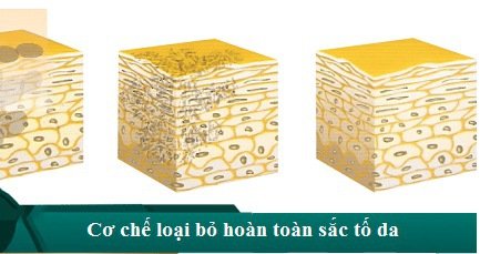 trị tàn nhang giá bao nhiêu