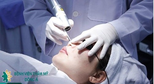 trị tàn nhang bao nhiêu tiền