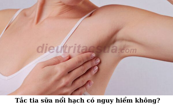 Tình trạng tắc tia sữa này có nguy hiểm không? 
