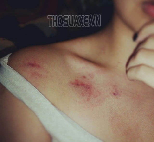 anh-hickey