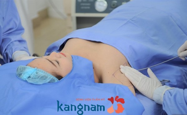 benh-vien-tham-my-kangnam-tp-ho-chi-minh-4