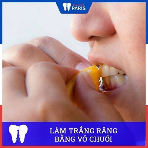 mẹo làm trắng răng ở nhà