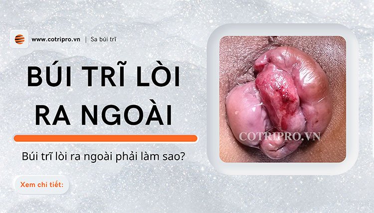 Búi trĩ lòi ra ngoài phải làm sao? 3 Cách làm co teo búi trĩ hiệu quả nhanh nhất 1