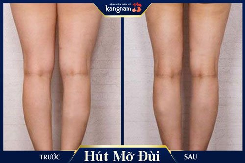 cách giảm mỡ dui nhanh nhất webtretho