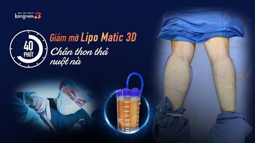 cách làm đùi nhỏ 