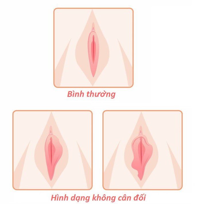 Cách làm hồng âm đạo tưởng khó mà dễ