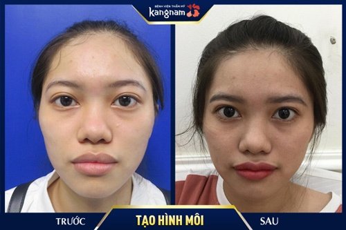 cách làm môi mỏng tại nhà