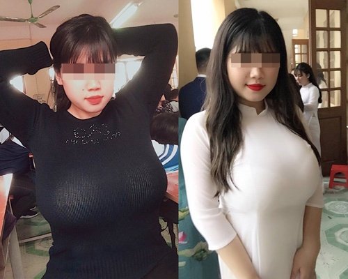 Ngực to quá khổ sẽ khó hợp với những trang phục cổ cao, bó sát cơ thể cách làm ngực bé lại