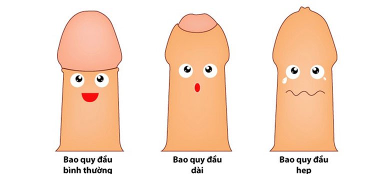 Hẹp/dài bao quy đầu là nguyên nhân khiến quy đầu nhạy cảm hơn