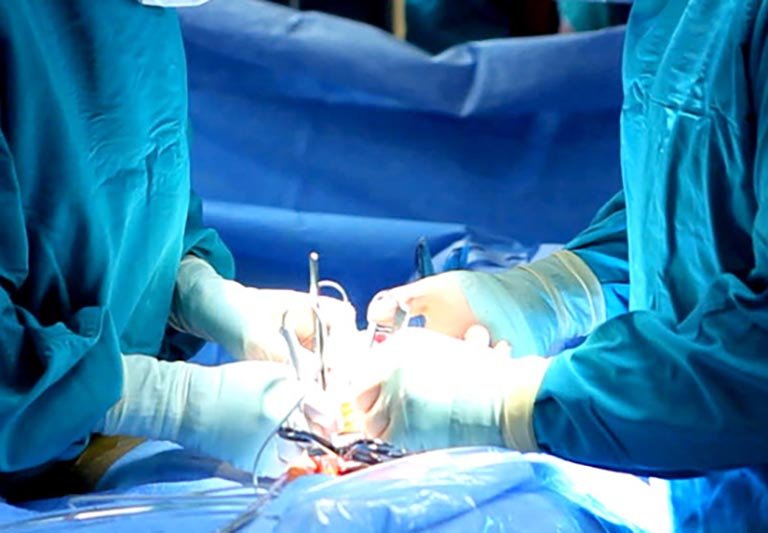 Can thiệp ngoại khoa cũng là một cách làm quy đầu bớt nhạy cảm