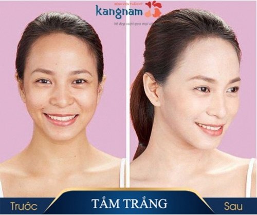 cách làm trắng da tay nhanh nhất