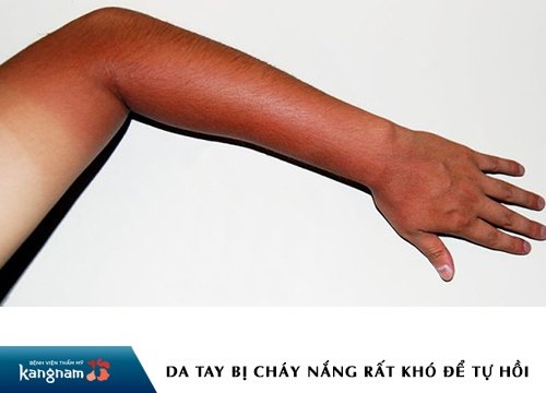 cách làm trắng da tay