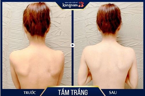 công thức làm trắng da toàn thân