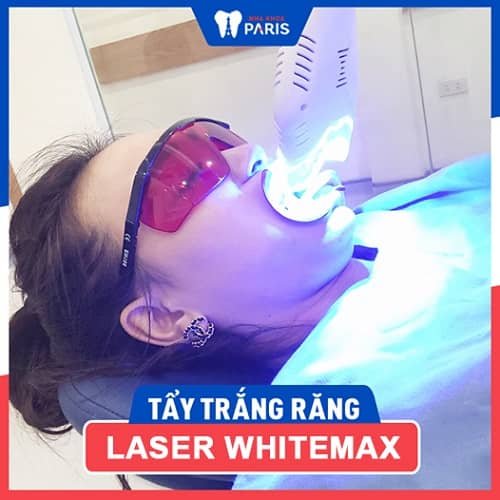 whitemax hiệu quả hơn làm trắng răng tại nhà