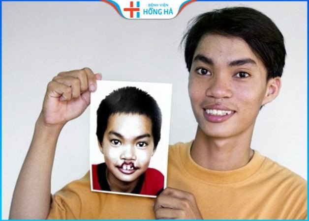 Kết quả phẫu thuật sau nhiều lần thực hiện