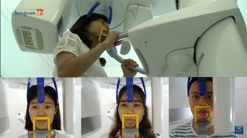 Khách hàng kiểm tra sức khỏe, chụp xương để xác định tình trạng khuyết điểm chữa mặt lệch