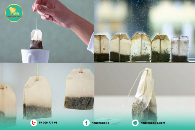 5 phương pháp làm chết tủy răng tại nhà 5 bã trà