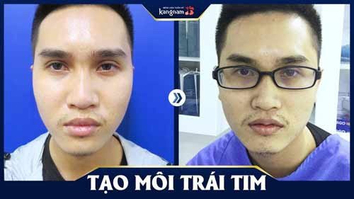 đàn bà môi mỏng