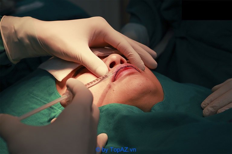 Địa chỉ cắt môi trái tim đẹp tại Hà Nội