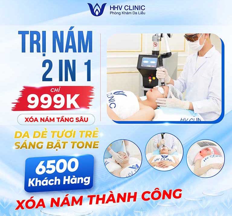 trị nám uy tín tại tphcm