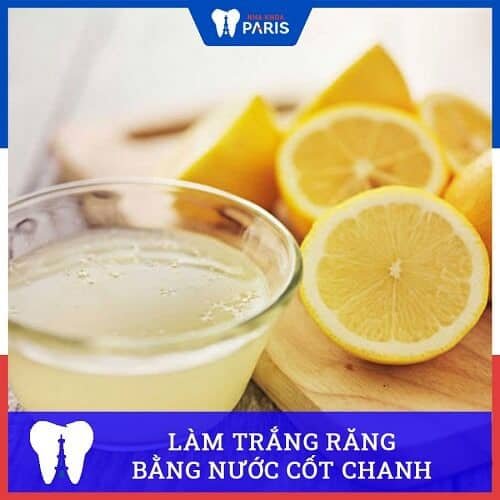 cách làm trắng răng đơn giản tại nhà