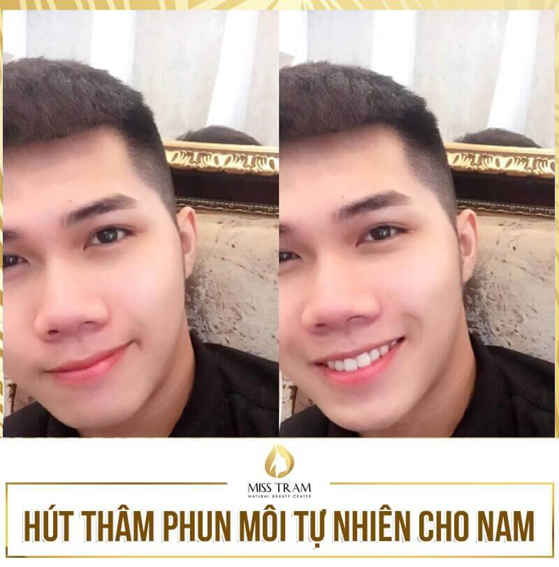 Phương pháp làm đẹp môi tự nhiên cho nam tại Spa uy tín