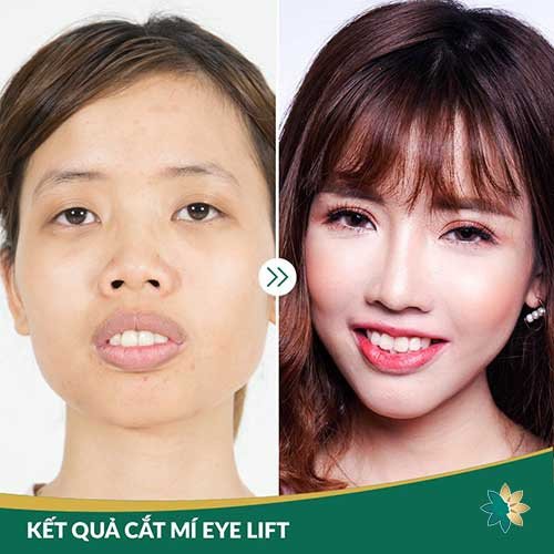 làm đẹp đông á cần thơ