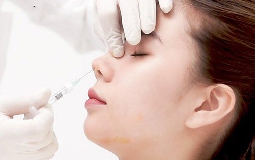 làm mũi cao không phẫu thuật