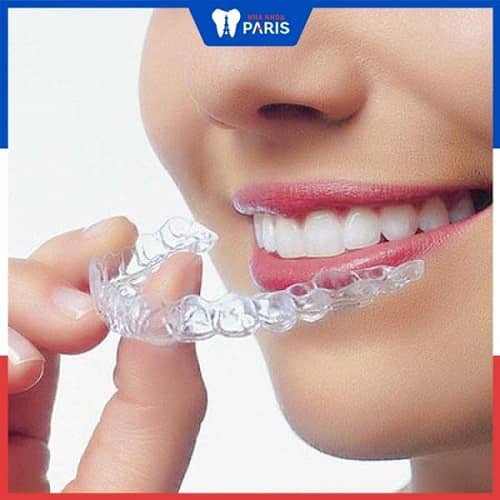 cách làm trắng răng ố vàng tại nhà Kinh nghiệm làm trắng răng bị ố vàng lâu năm với Máng Tẩy Trắng