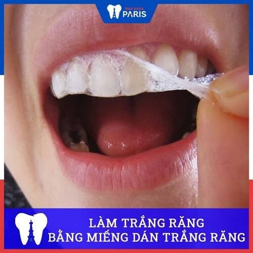 cách làm trắng răng hiệu quả tức thì nhanh nhất