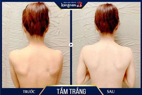 làm trắng da tay và chân nhanh