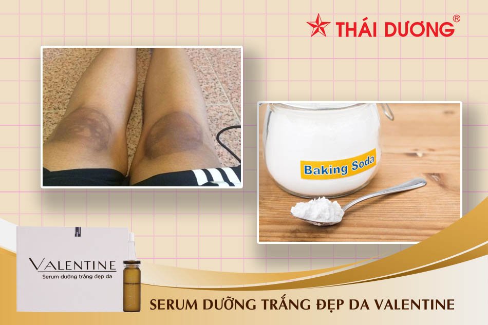 Cách làm trắng da đầu gối bằng Baking soda