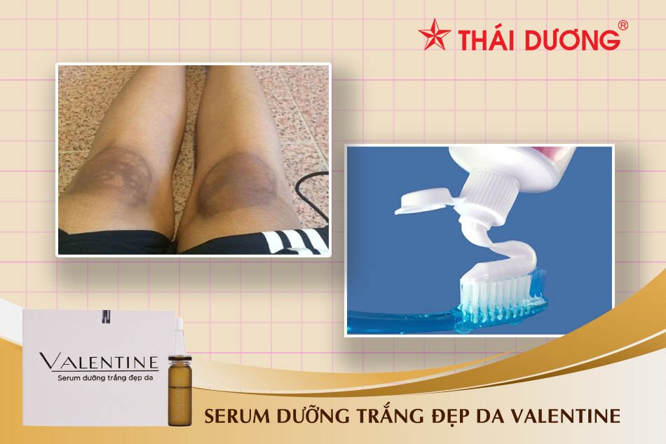 Làm trắng da vùng đầu gối bằng kem đánh răng