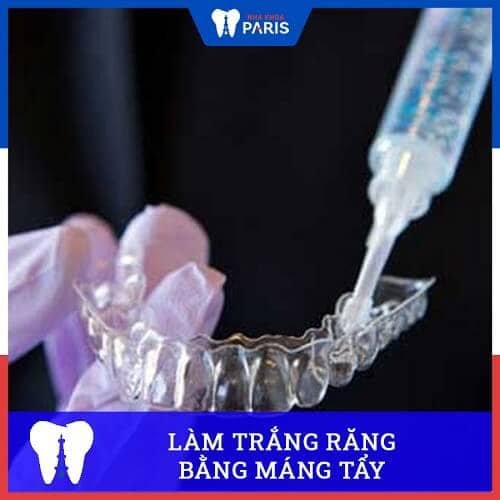 cách làm trắng răng ngay lập tức