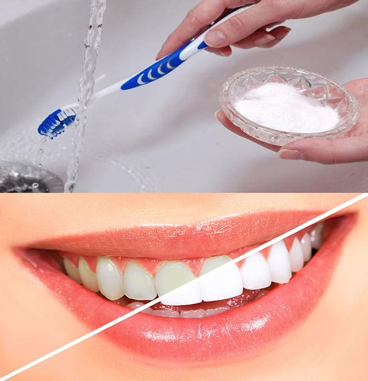 Cách thực hiện làm trắng răng với nước vo gạo đặc Cho gạo vào nước rồi thực hiện dùng tay khuấy nhẹ để tách sạn, chất bẩn ra khỏi gạo. Bắt đầu từ nước thứ 2 trở đi, bạn không đổ nước vo gạo đi m2 cho vào trong 1 cái chậu nhỏ. Đậy kín và để qua đêm. Sáng hôm sau, bạn sẽ thấy phần nước gạo đặc lắng xuống đáy chậu. Phần nước đục nằm phía trên chính là phần nước gạo lỏng. Chắt lấy nước đặc dưới đáy chậu và cho vào một lọ thủy tinh sạch. Sau đó cho vào tủ lạnh để bảo quản và sử dụng hằng ngày. Khi đánh răng, thay vì dùng kem đánh răng, hãy dùng nước vo gạo đặc để đánh trực tiếp. Tiếp đó, bạn chải răng nhẹ nhàng trong khoảng 5 phút rồi súc lại bằng nước sạch. Nếu bạn cảm thấy nước vo gạo không đủ làm sạch răng thì có thể dùng kem đánh răng thêm sau đó. Áp dụng phương pháp làm trắng răng với nước vo gạo này đều đặn hằng ngày để thấy công dụng sau 3-4 tuần.