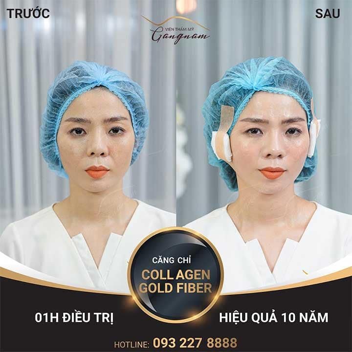 Lệ quyên đi thẩm mỹ viện tại Hà Nội 