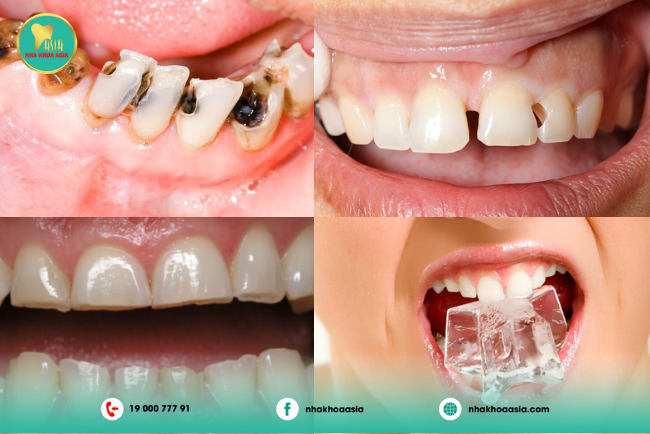 5 phương pháp làm chết tủy răng tại nhà 2 Vì sao cần phải làm chết tủy răng