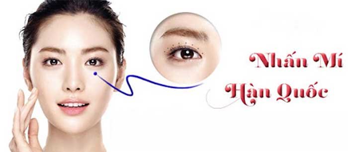 Top 5 Cách Tạo Mắt 2 Mí Không Cần Phẫu Thuật Hiệu Quả 1