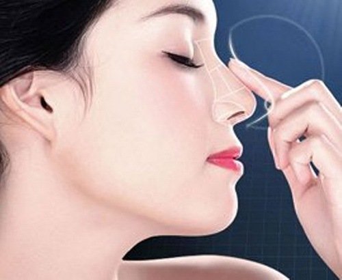 làm sống mũi cao tự nhiên