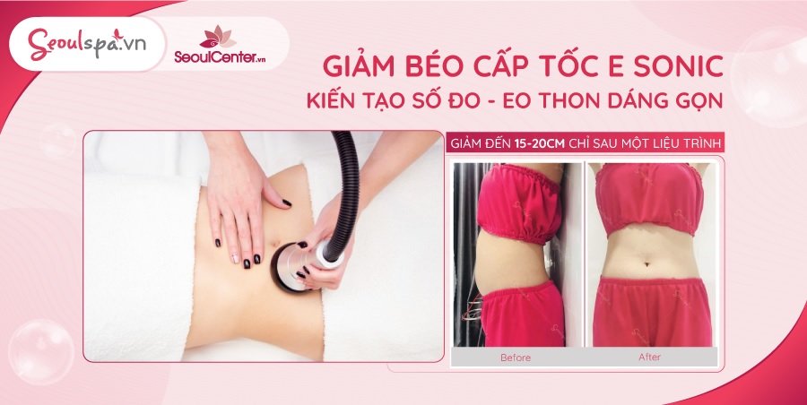 Công nghệ giảm béo cấp tốc tại SeoulSpa.Vn
