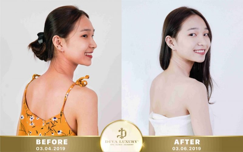 tắm trắng phi thuyền là gì