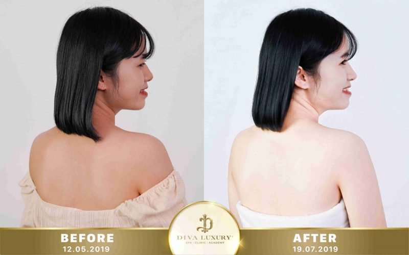 tắm trắng phi thuyền là gì