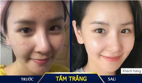 tắm trắng kangnam