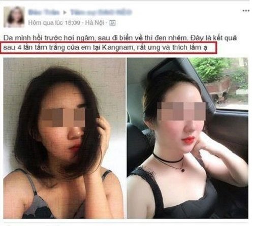 tắm trắng ở đâu an toàn