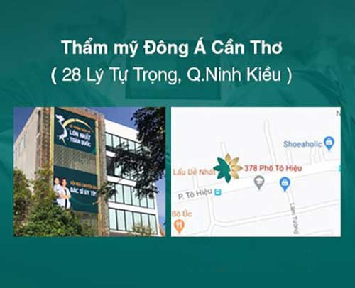 thẩm mỹ cần thơ