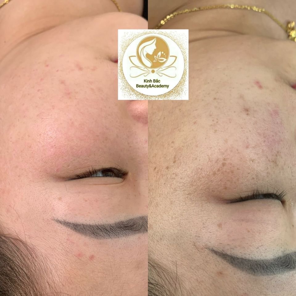 thẩm mỹ viện Bắc Ninh