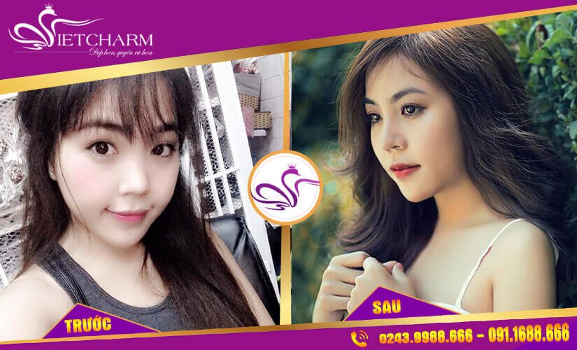  Viet Charm